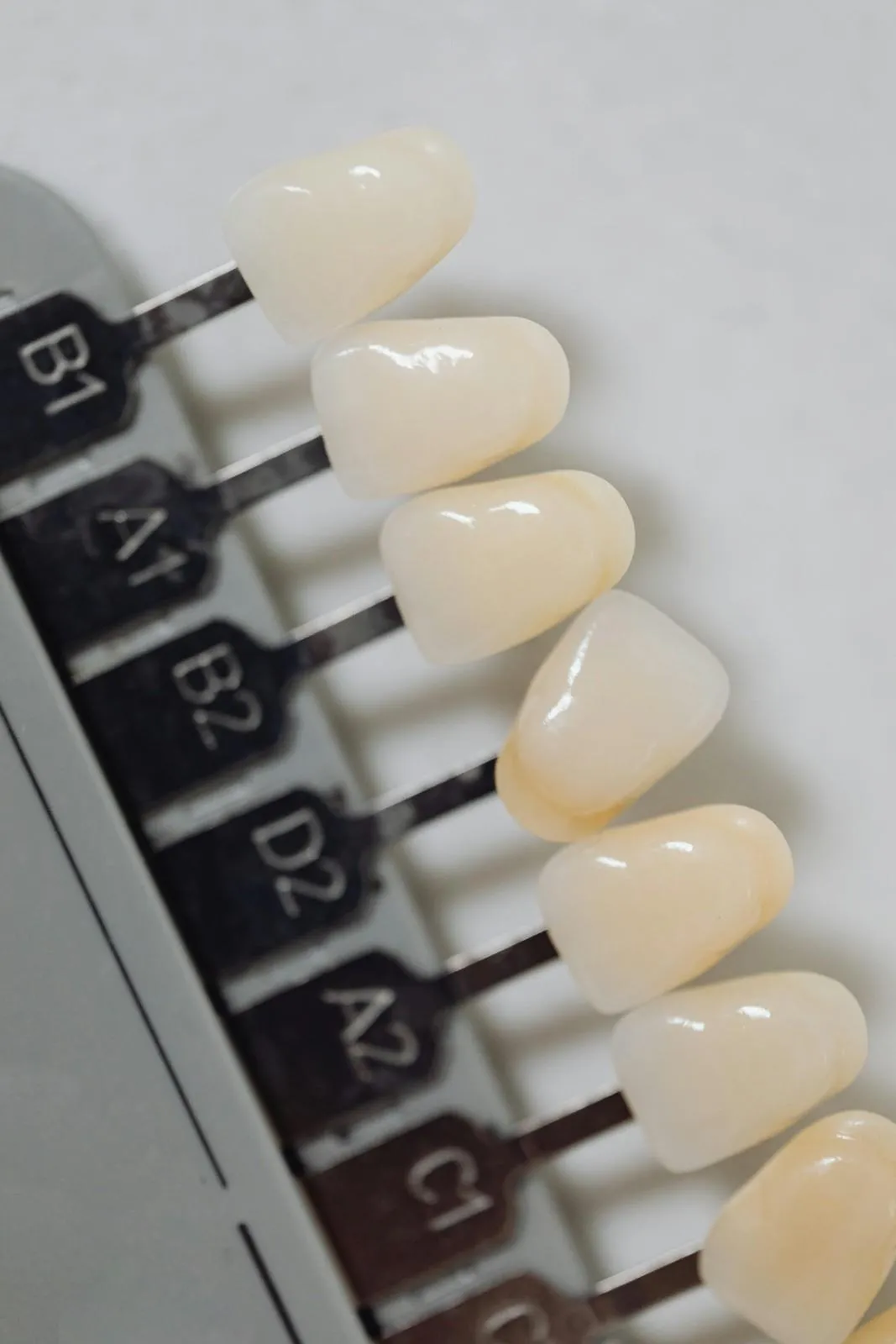 تبييض الأسنان